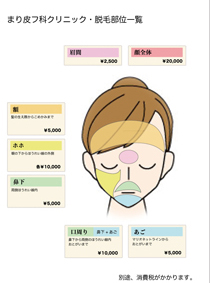 脱毛　顔